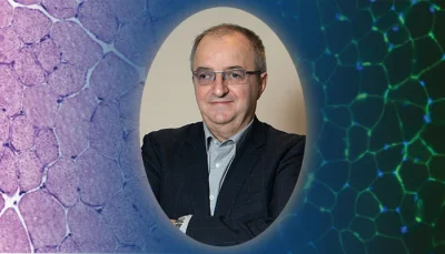 A COLLABORATIVE EFFORT INVOLVING AN IBG RESEARCHER UNVEILS THE ROLE OF A HISTONE VARIANT IN TRANSCRIPTION