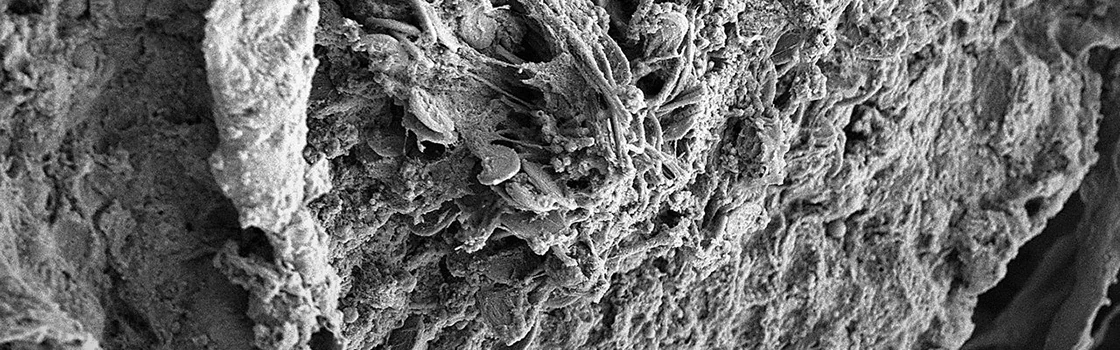 elektron mikroskobisi